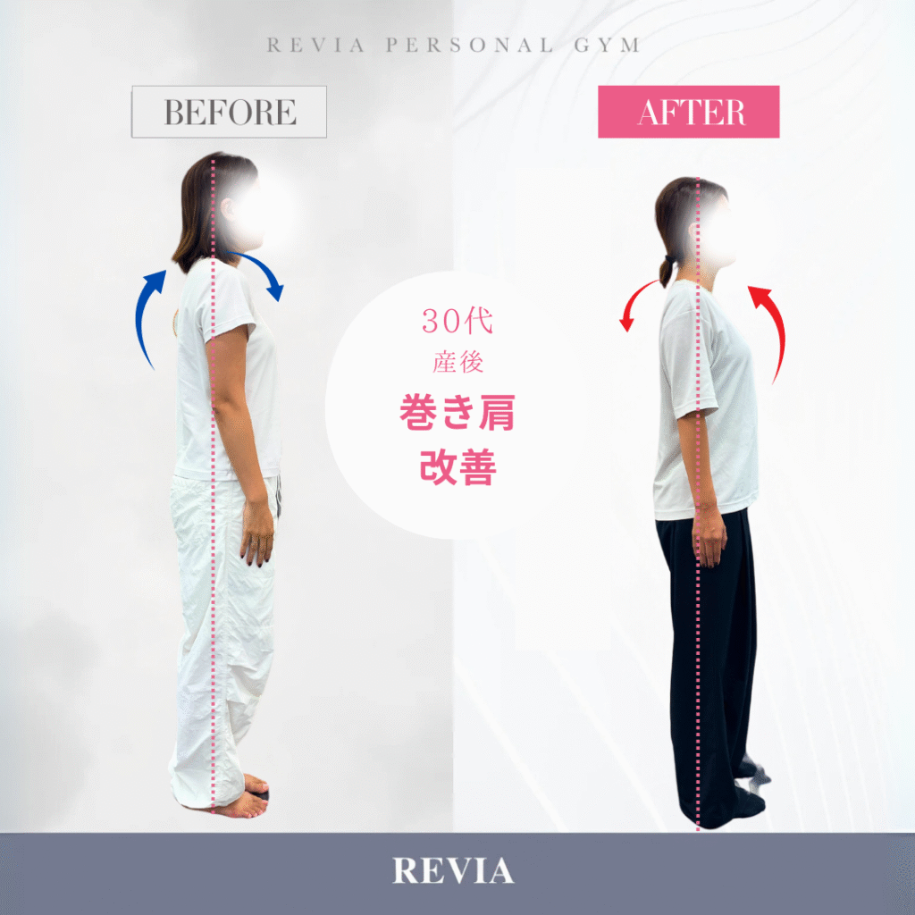 【守谷の女性専用ジム】産後の巻き肩・姿勢改善で自信の持てるカラダに!